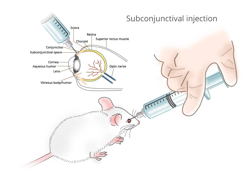 B-05-Subconjunctival injection