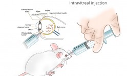 Intravitreal-Injection Administration